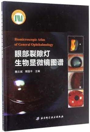 眼部裂隙灯生物显微镜图谱