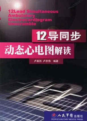 12导同步动态心电图解读