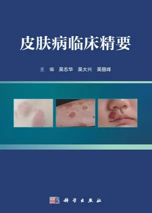 皮肤病临床精要