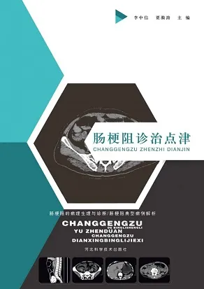 肠梗阻诊治点津