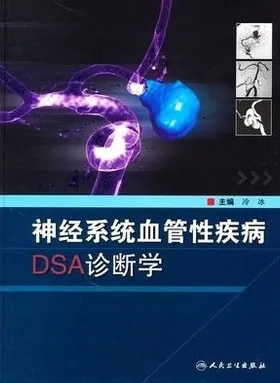 神经系统血管性疾病DSA诊断学