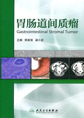 胃肠道间质瘤