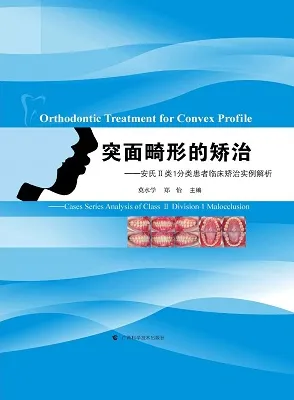突面畸形的矫治 安氏II类1分类患者临床矫治实例解析