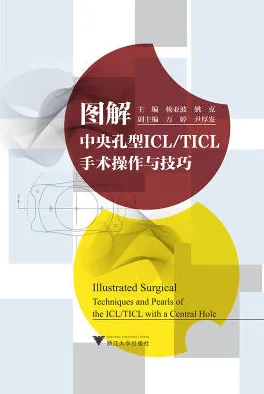 图解中央孔型ICL TICL手术操作与技巧