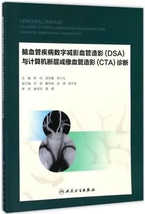 脑血管疾病数字减影血管造影（DSA）与计算机断层成像血管造影（CTA）诊断