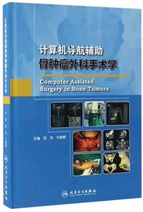 计算机导航辅助骨肿瘤外科手术学
