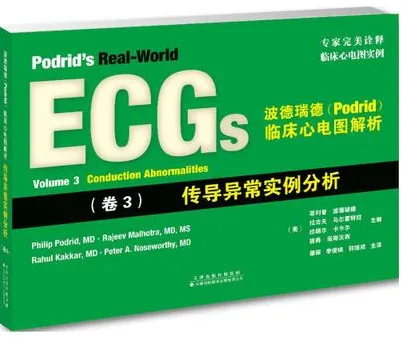 波德瑞德临床心电图解析 卷3 传导异常实例分析