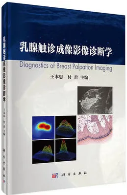 乳腺触诊成像影像诊断学