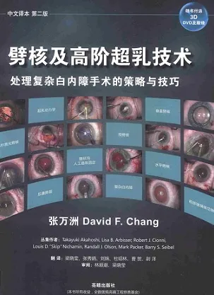 劈核及高阶超乳技术处理复杂白内障手术的策略与技巧 第2版