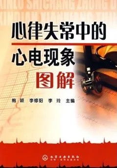 心律失常中的心电现象图解
