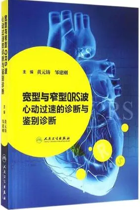 宽型与窄型QRS波心动过速的诊断与鉴别诊断
