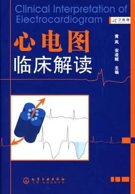 心电图临床解读