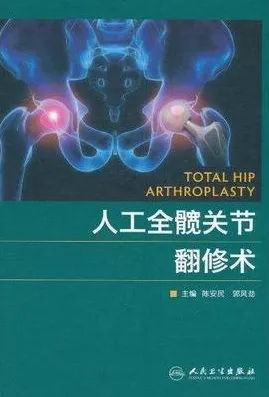 人工全髋关节翻修术