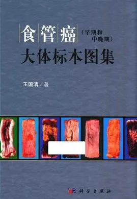 食管癌（早期和中晚期）大体标本图集
