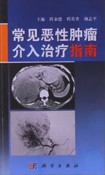 常见恶性肿瘤介入治疗指南