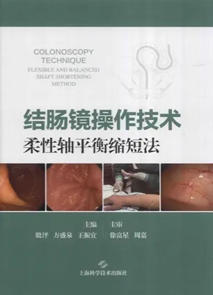 结肠镜操作技术 柔性轴平衡缩短法