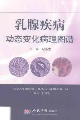 乳腺疾病动态变化病理图谱