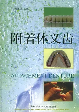 附着体义齿