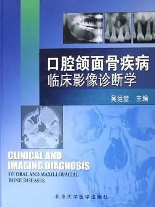 口腔颌面骨疾病临床影像诊断学
