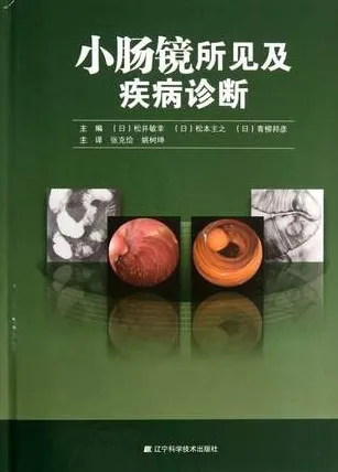 小肠镜所见及疾病诊断