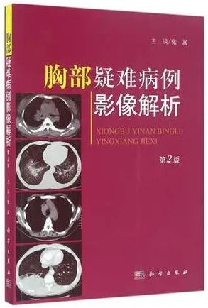 胸部疑难病例影像解析 第2版