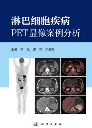 淋巴细胞疾病PET显像案例分析