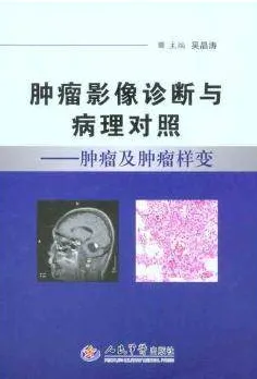 肿瘤影像诊断与病理对照 肿瘤及肿瘤样变