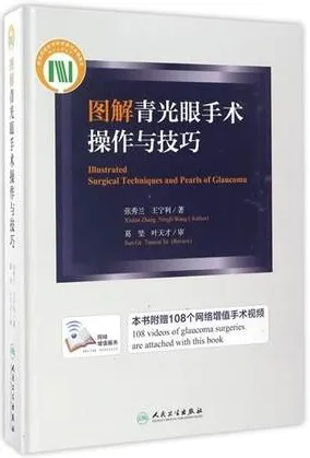图解青光眼手术操作与技巧
