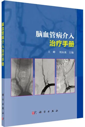 脑血管病介入治疗手册