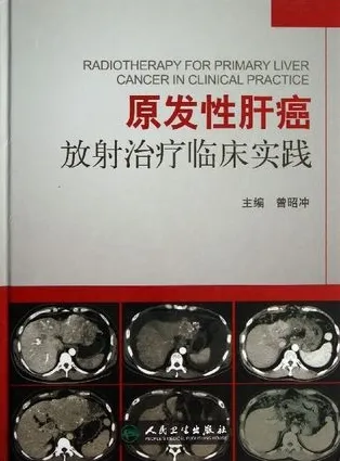 原发性肝癌放射治疗临床实践