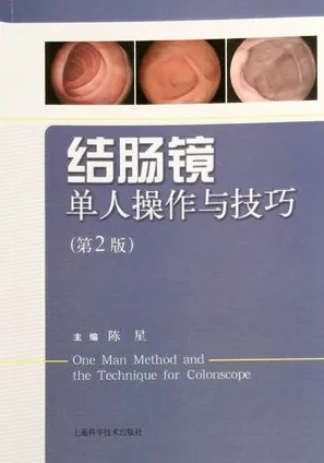 结肠镜单人操作与技巧（第2版）