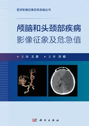 颅脑和头颈部疾病影像征象及危急值