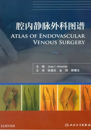 腔内静脉外科图谱