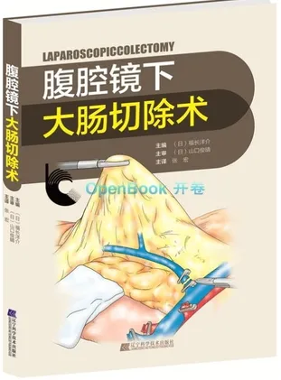 腹腔镜下大肠切除术