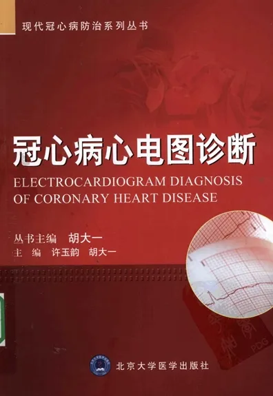 冠心病心电图诊断
