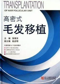 高密式毛发移植