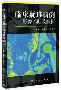 临床疑难病例影像诊断及解析