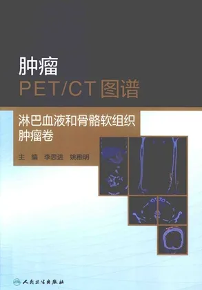 肿瘤PET／CT图谱 淋巴血液和骨骼软组织肿瘤卷