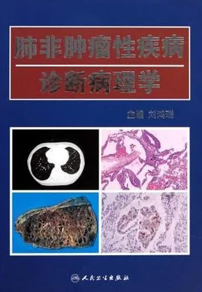 肺非肿瘤性疾病诊断病理学