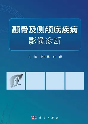 颞骨及侧颅底疾病影像诊断