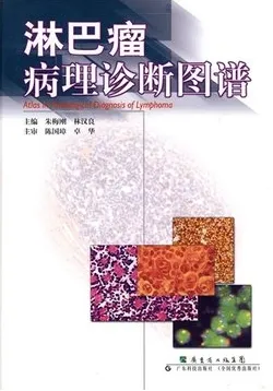 淋巴瘤病理诊断图谱